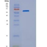 小鼠羧酸酯酶2(CES2)重组蛋白His tag