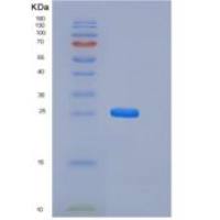 大鼠Serum amyloid P component / APCS / SAP重组蛋白His tag