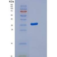 小鼠CD99 / PILR1重组蛋白Fc tag