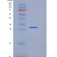 人TREML2 / TLT2重组蛋白His tag