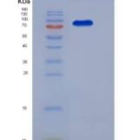 小鼠c-kit / CD117重组蛋白Fc tag