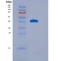 小鼠组织蛋白酶E(CTSE)重组蛋白His Tag