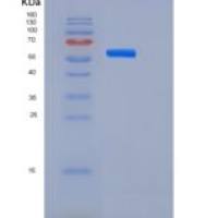 人肝配蛋白B受体2(EPHB2)重组蛋白His tag