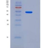 小鼠CHST3 / C6ST-1重组蛋白His tag