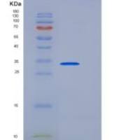 小鼠Osteonectin / SPARC重组蛋白His tag