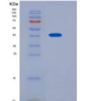 人IL-1RAcP / IL-1R3重组蛋白His tag