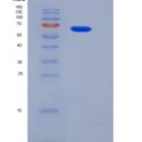 大鼠成纤维细胞生长因子受体4(FGFR4)重组蛋白Fc tag