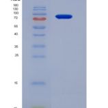 人补体成分2(C2)重组蛋白His tag
