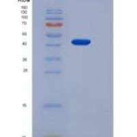 人Coagulation Factor VII / FVII / F7重组蛋白His tag