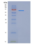 大鼠UNC5B / UNC5H2重组蛋白Fc tag