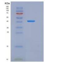 人补体因子H(CFH)重组蛋白His tag