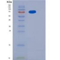 人Siglec-2 / CD22重组蛋白His tag
