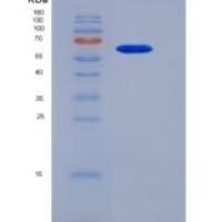 人醛脱氢酶1家族成员A1(ALDH1A1)重组蛋白