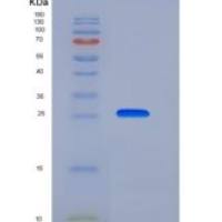 大鼠泛素羧基端酯酶L3(UCHL3)重组蛋白His tag