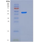 人IL2Ra / CD25重组蛋白Fc tag