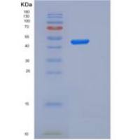 人IL2Ra / CD25重组蛋白Fc tag