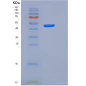 人IL2Ra / CD25重组蛋白Fc tag