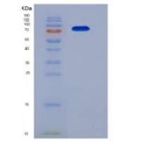 小鼠TGFBR3 / Betaglycan重组蛋白His tag