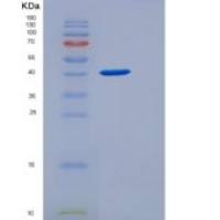 人SULT2B1重组蛋白His Tag