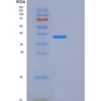 小鼠WNT抑制因子1(WIF1)重组蛋白His tag