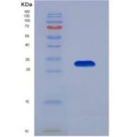 小鼠分层蛋白(SFN)重组蛋白