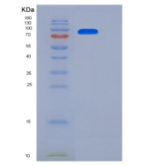 小鼠HER2 / ErbB2重组蛋白Fc tag