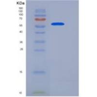 人CD68 / Macrosialin / Gp110重组蛋白His & Fc tag