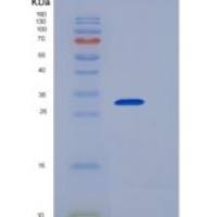 人IL17BR / IL17RB / IL-17 Receptor B重组蛋白His tag