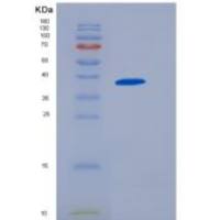 小鼠细胞粘附分子1(CADM1)重组蛋白His Tag