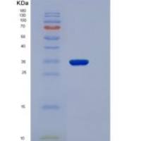 人NMNAT1 / NMNAT重组蛋白His tag