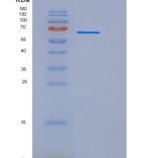 大鼠UNC5B / UNC5H2重组蛋白Fc tag