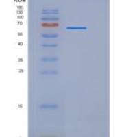 大鼠UNC5B / UNC5H2重组蛋白Fc tag