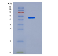 小鼠PLA2G7 / PAFAH重组蛋白His Tag