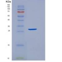 人SULT1A3重组蛋白His Tag