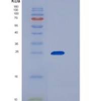 人Factor D重组蛋白His Tag