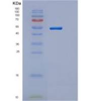 人胰岛素(INS)重组蛋白