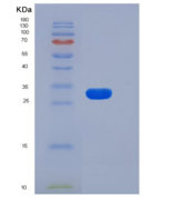 人FGFR1 / CD331重组蛋白His tag