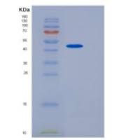 人SerpinB9重组蛋白His Tag