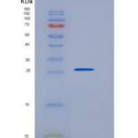 大鼠KIM-1 / TIM1 / HACVR1重组蛋白His tag