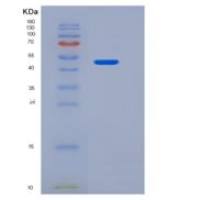 小鼠TNFR1 / CD120a / TNFRSF1A重组蛋白Fc tag