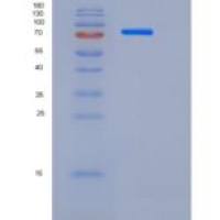 人δ样蛋白4(dLL4)重组蛋白Fc tag