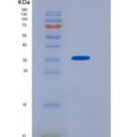 人NMNAT2 / NMNAT-2重组蛋白His tag