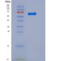 小鼠Toll样受体2(TLR2)重组蛋白His tag