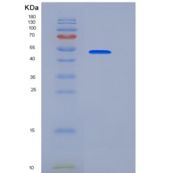 小鼠DPP7 / DPPII / DPP2重组蛋白His tag