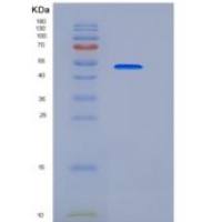 小鼠DPP7 / DPPII / DPP2重组蛋白His tag