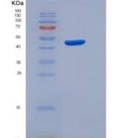 人ULBP1 / RAET1 / N2DL1重组蛋白His & Fc tag