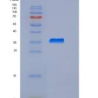 人ARG1 / Arginase 1重组蛋白His tag