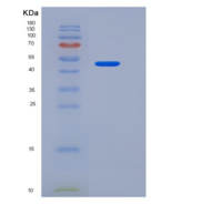小鼠TNFR1 / CD120a / TNFRSF1A重组蛋