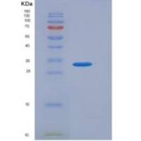 人组织蛋白酶Z(CTSZ)重组蛋白His Tag