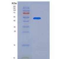 人B7-H3 / CD276重组蛋白His tag